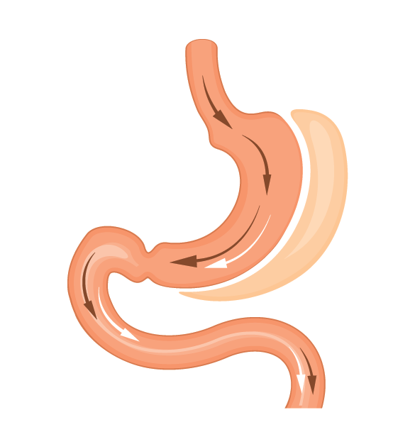 do you need b12 injections after gastric sleeve Do You Still Need B12 Injections After Bariatric Surgery? – Bari Enhance main image 0