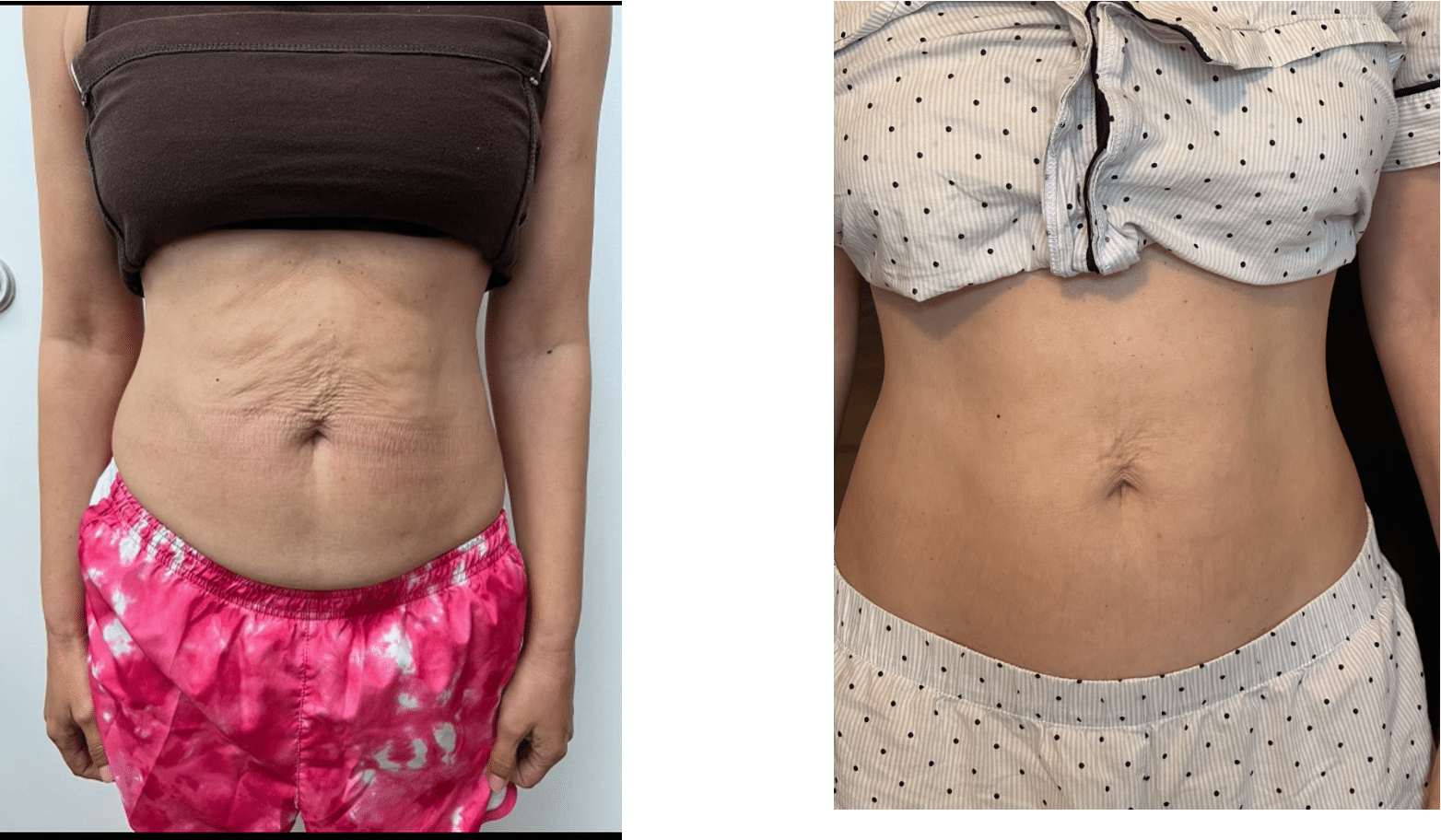 IMG 3045