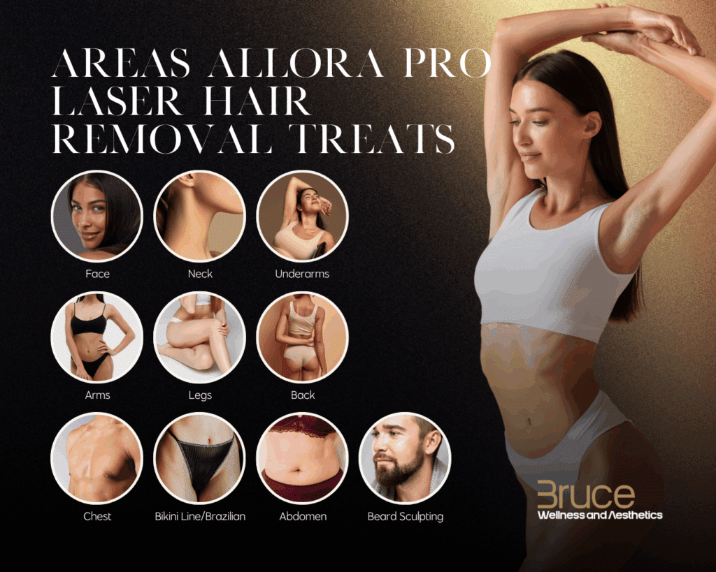 Areas Allora Pro Laser Hair Removal Treats