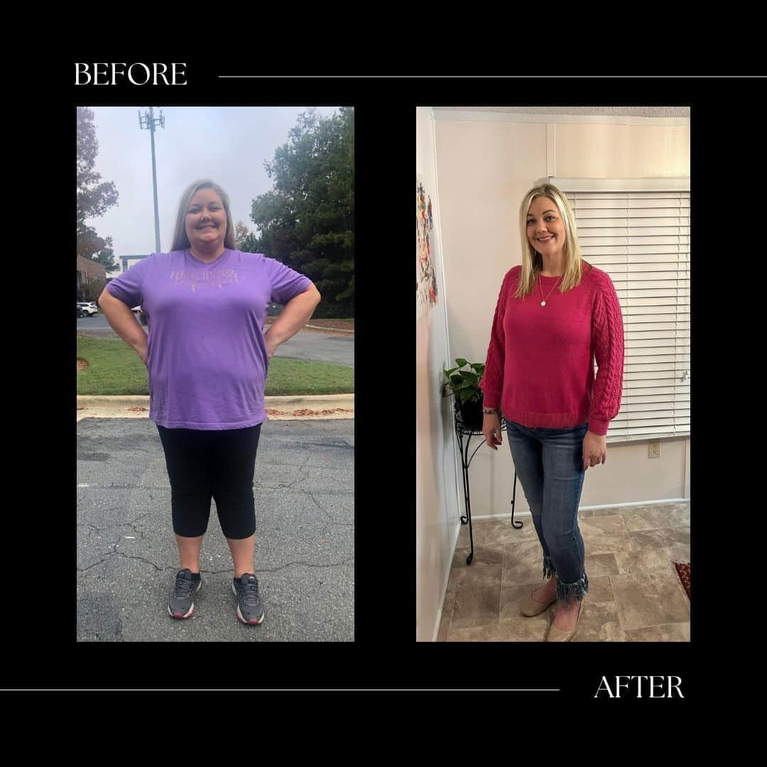 surgical weight loss before and after cary nc