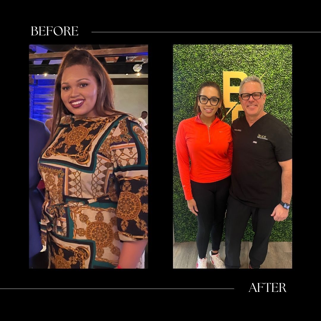 surgical weight loss before and after cary nc