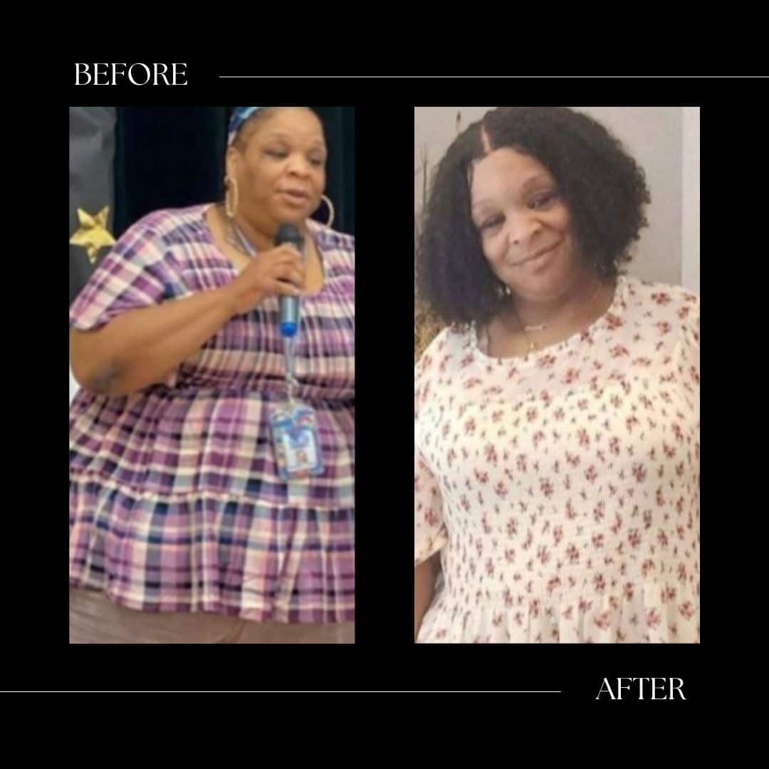 surgical weight loss before and after cary nc