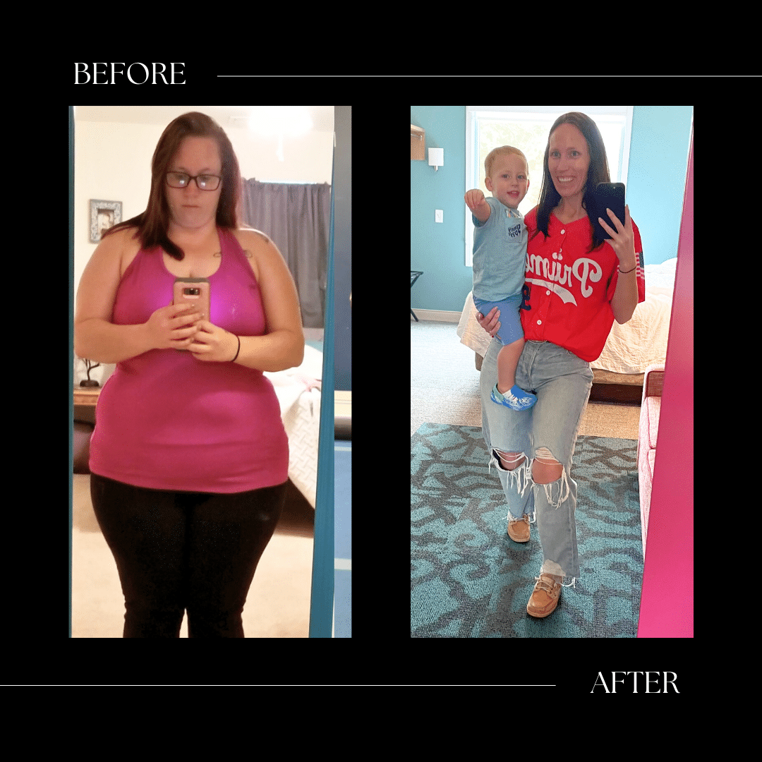 surgical weight loss before and after cary nc
