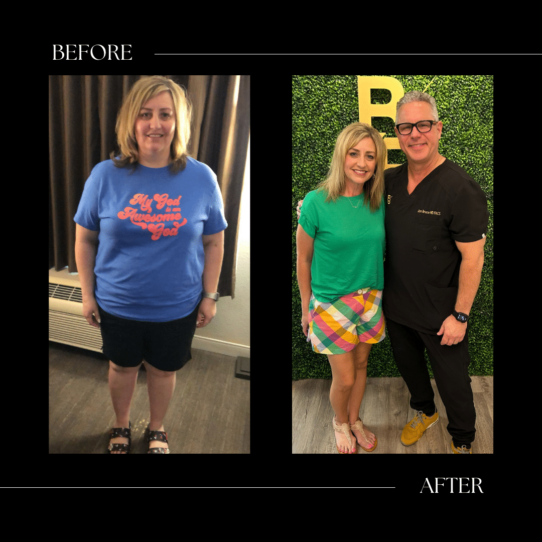surgical weight loss before and after cary nc