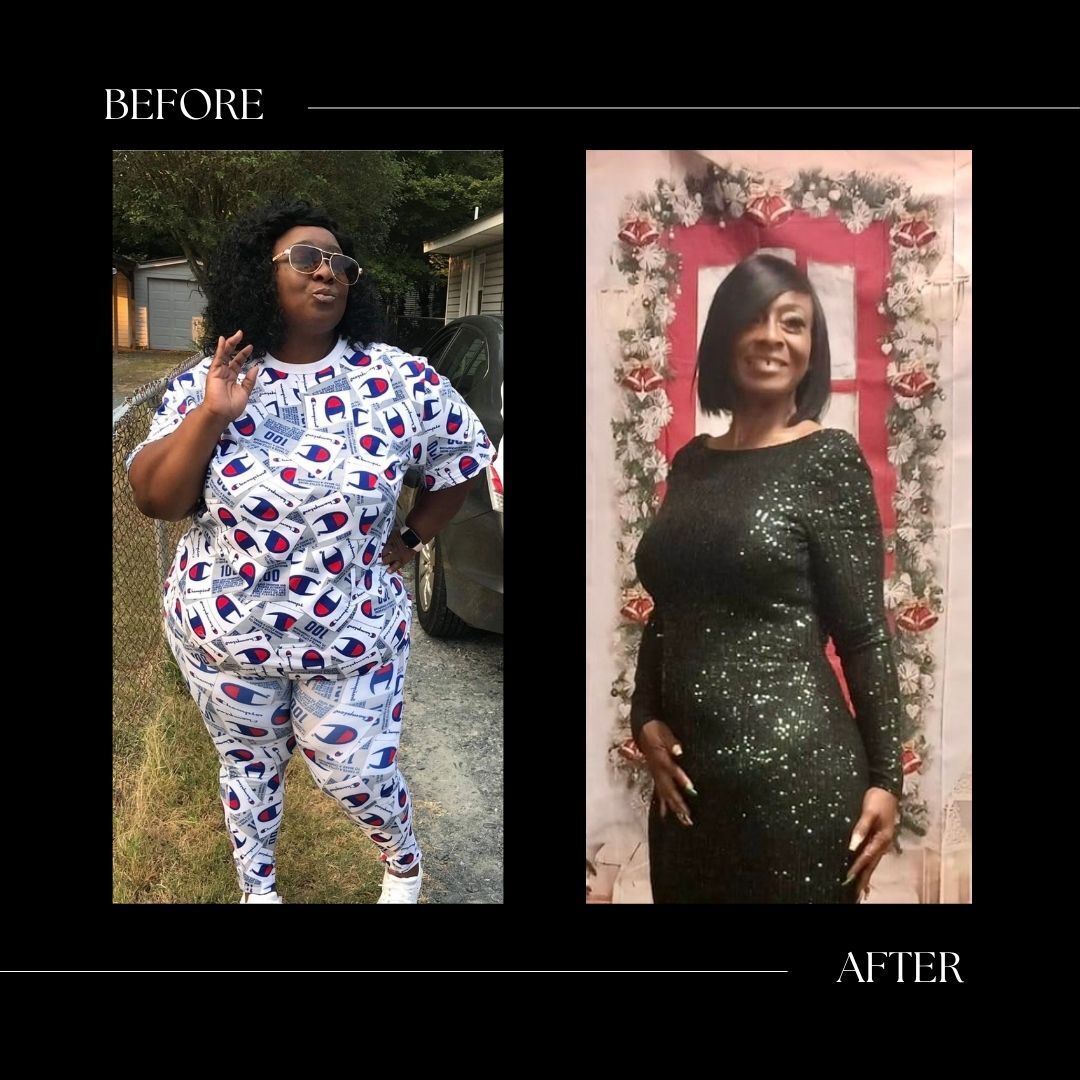 surgical weight loss before and after cary nc