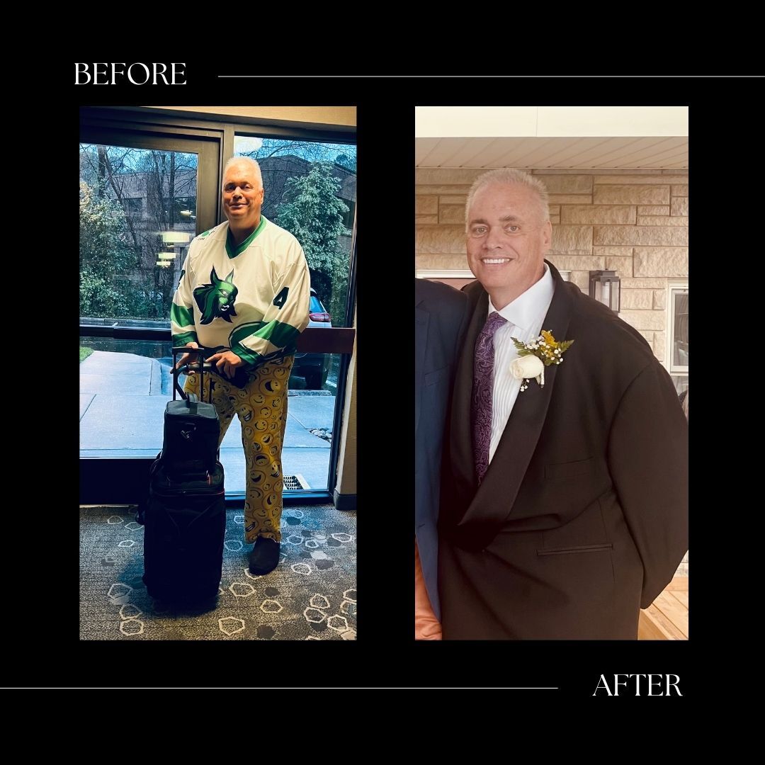 weight loss before and after cary nc
