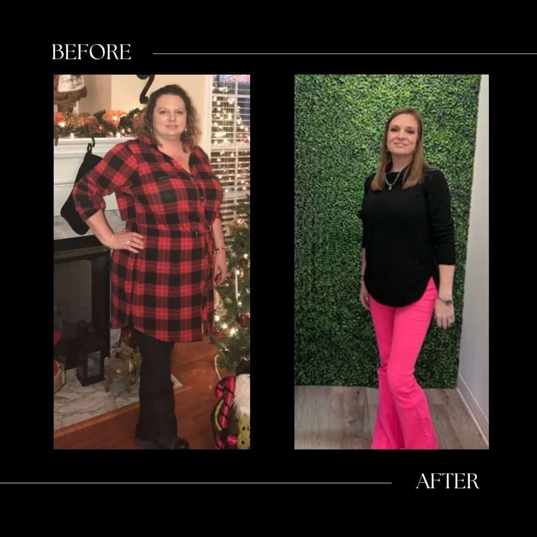 surgical weight loss before and after cary nc