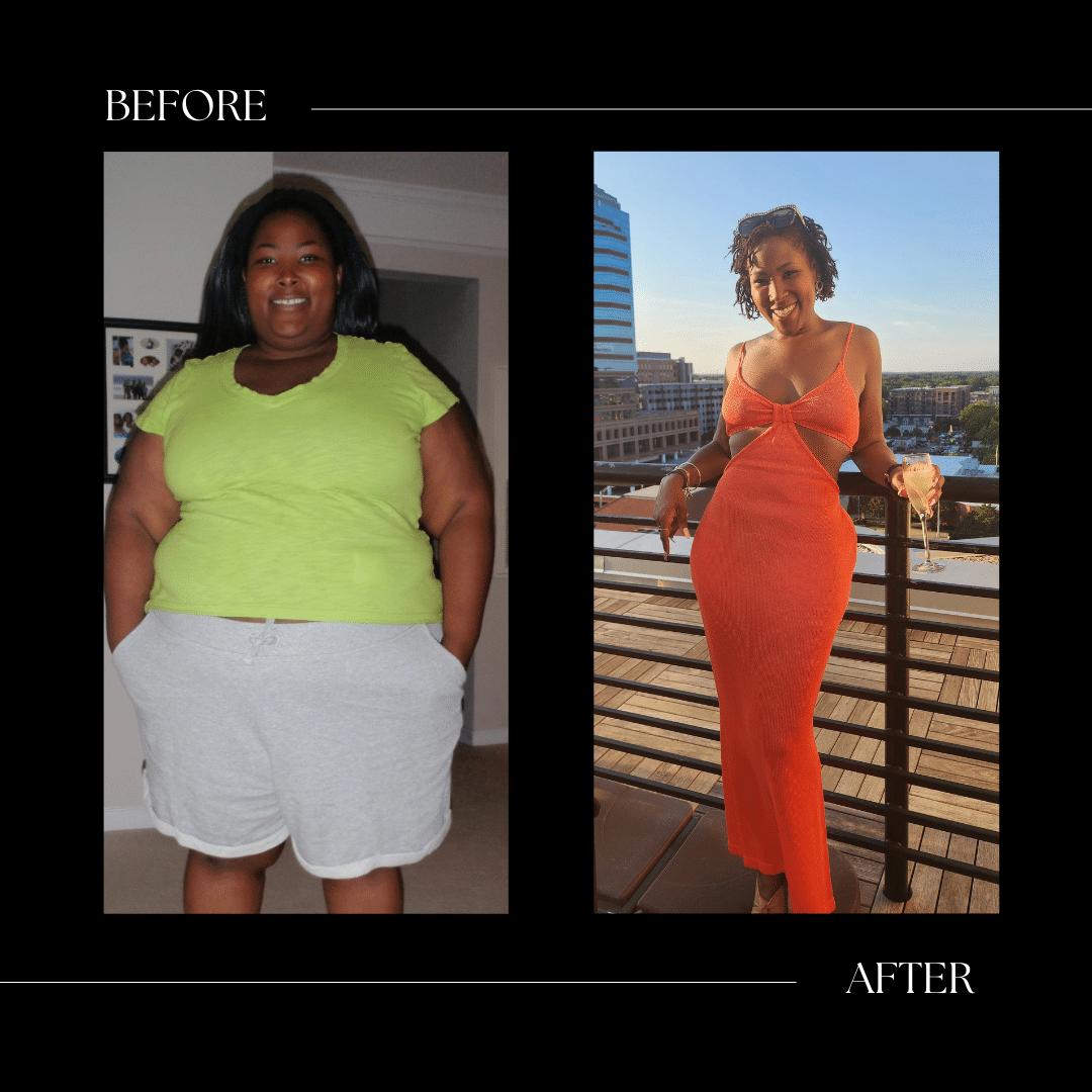 surgical weight loss before and after cary nc