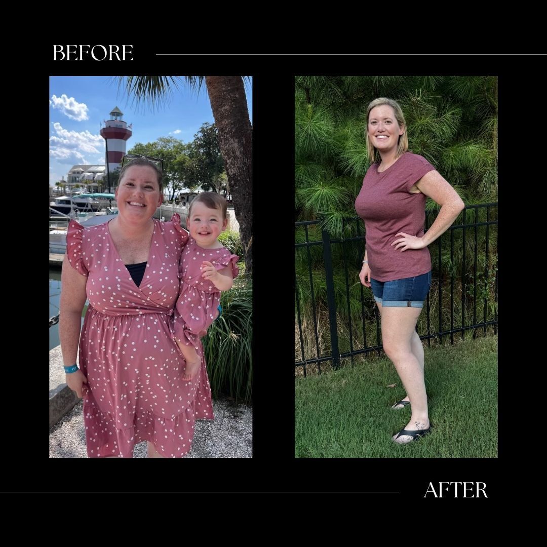 weight loss before and after cary nc