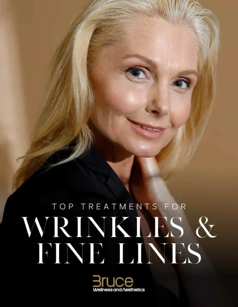 fine lines and wrinkles ebook cover bwamed