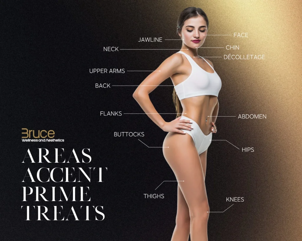 Areas Accent Prime Treats