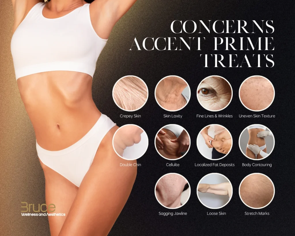 Concerns Accent Prime Treats