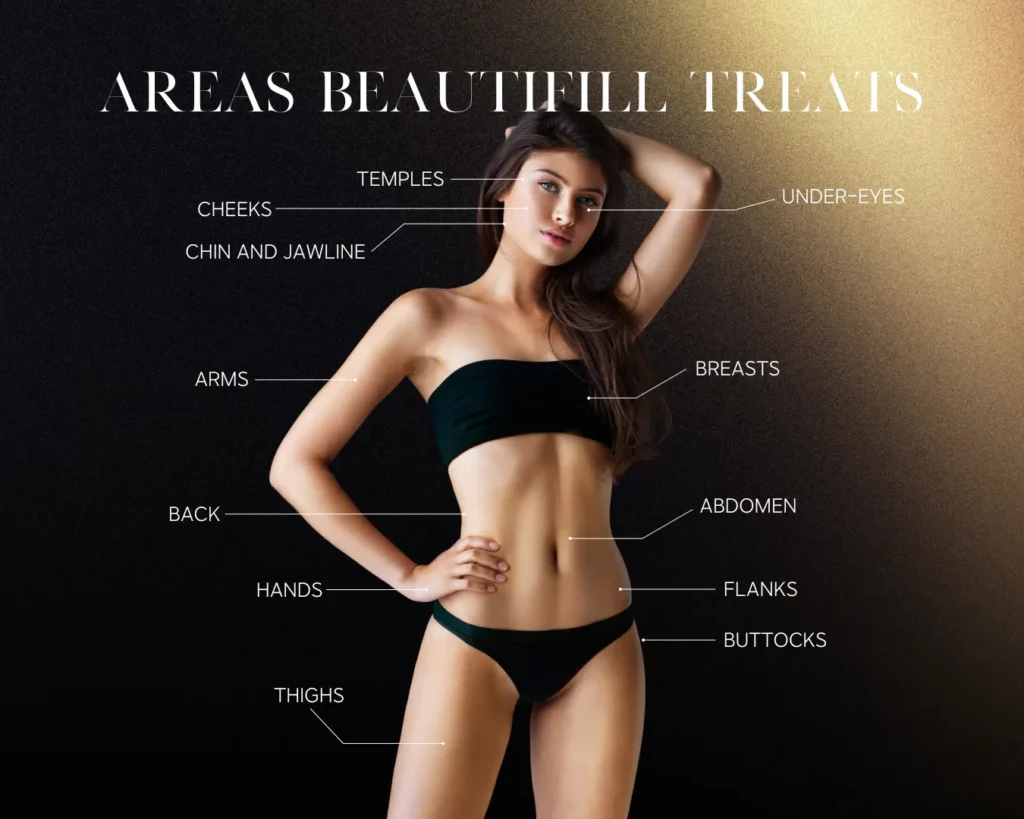 Areas BeautiFill Treats