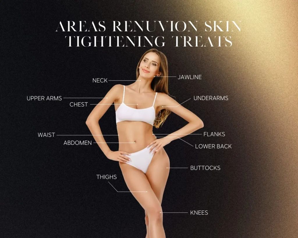 Areas Renuvion Skin Tightening Treats